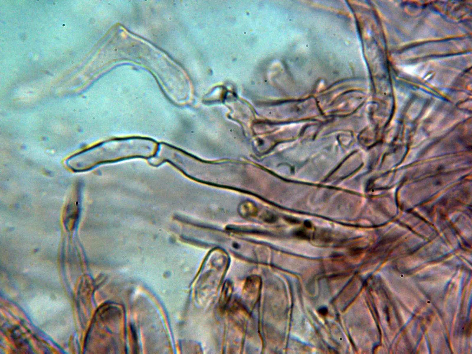 Microscopía de Scleroderma citrinum - 10 - Peridio 3
